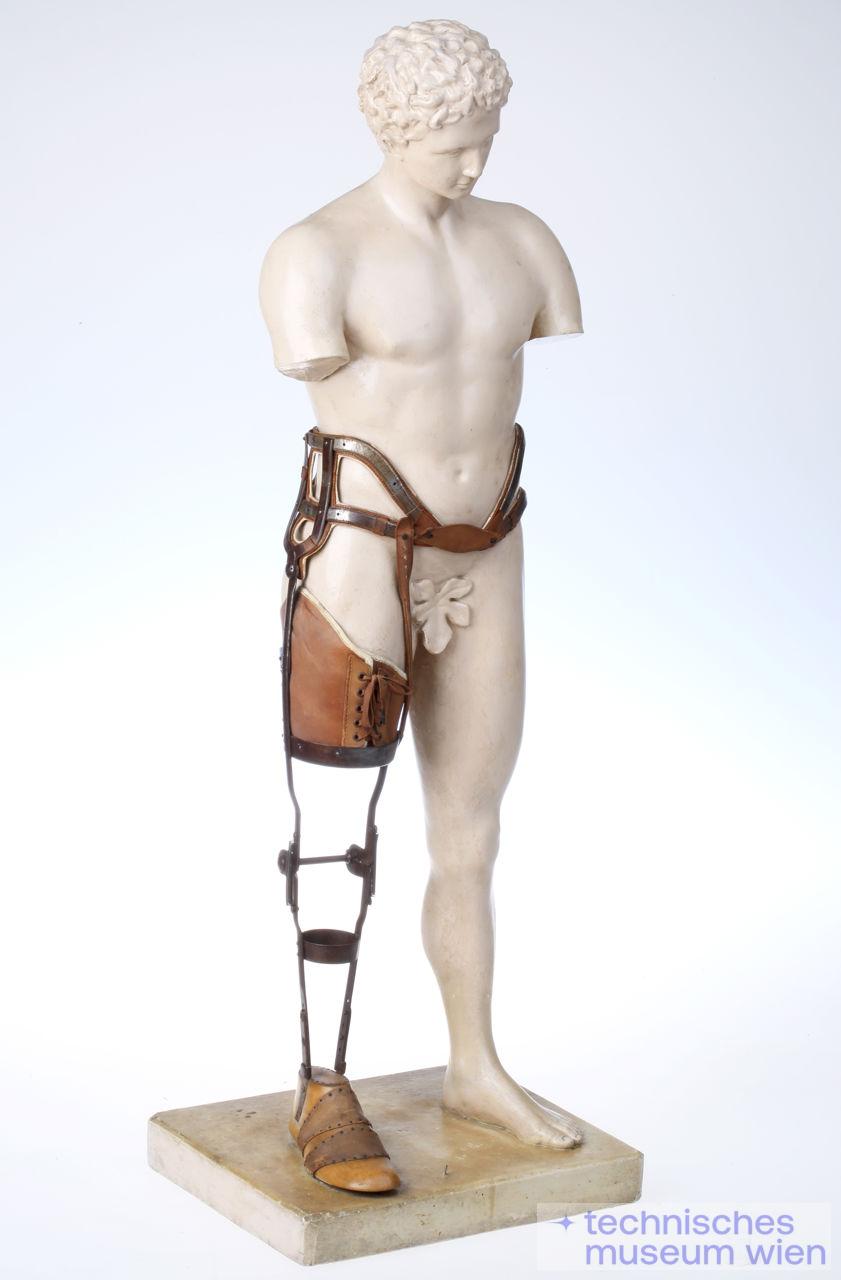 Statuette mit amputierten Armen und Oberschenkel